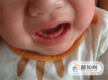 怎样知道宝宝快要长牙呢